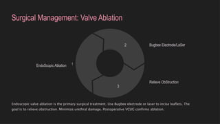 Posterior-Urethral-Valves-PUV-An-Overview (1).pptx