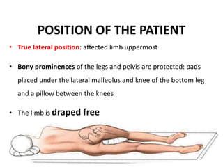 Moore Approach Posterior approach to the hip