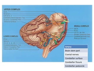 Artery
Brain stem part
Cranial nerves
Cerebellar surface
Cerebellar fissure
Cerebellar peduncle
 