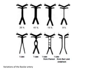 Variations of the Basilar artery
 