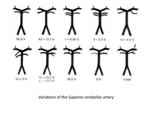 Variations of the Superior cerebellar artery
 