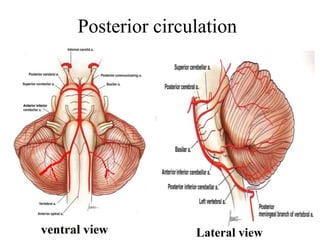 Posterior circulation
Lateral view
 