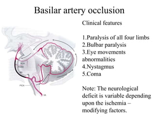 Basilar artery occlusion
Clinical features
1.Paralysis of all four limbs
2.Bulbar paralysis
3.Eye movements
abnormalities
4.Nystagmus
5.Coma
Note: The neurological
deficit is variable depending
upon the ischemia –
modifying factors.
 