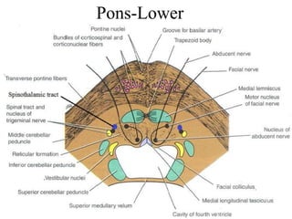 Pons-Lower
 