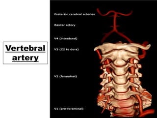 Vertebral
artery
 