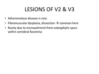 • Atheromatous disease is rare.
• Fibromuscular dysplasia, dissection  common here
• Rarely due to encroachment from osteophytic spurs
within vertebral foramina
LESIONS OF V2 & V3
 