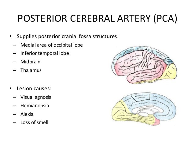 Posterior Cerebral Artery Syndrome - Captions Pages
