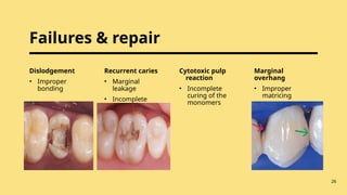 posterior composite.pptx about copmosire | PPTX | Dental Health ...