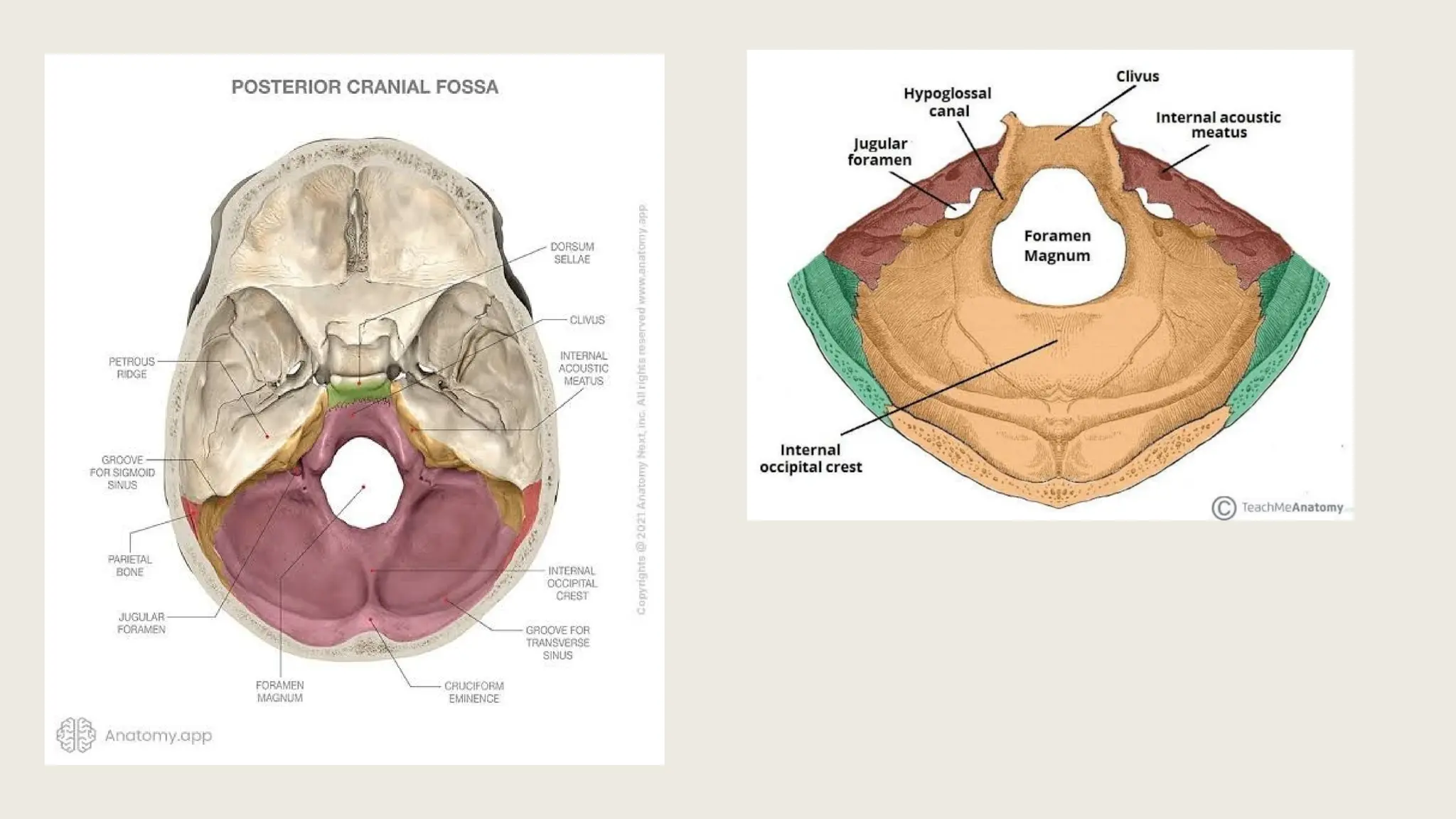 Posterior cranial fossa surgery and approach.pptx