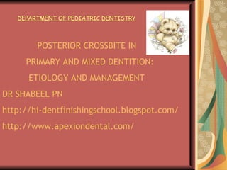 POSTERIOR CROSSBITE IN  PRIMARY AND MIXED DENTITION: ETIOLOGY AND MANAGEMENT DR SHABEEL PN http://hi-dentfinishingschool.blogspot.com/ http://www.apexiondental.com/ DEPARTMENT OF PEDIATRIC DENTISTRY 