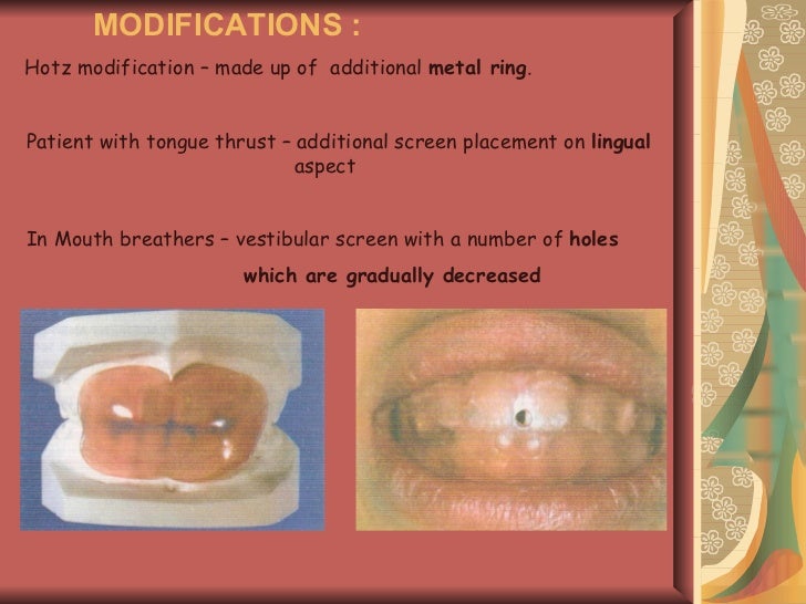 Posterior crossbite in_primary_and_mixed_dentition__etiology_and_man…