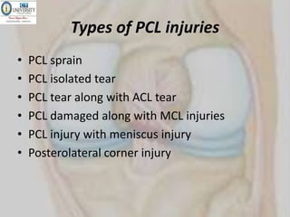 Posterior cruciate liagment.pptx