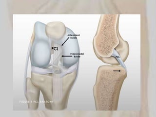 Pcl Posterior cruciate liagment.pptx