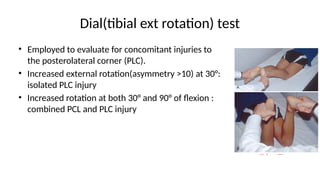 Sci Excessive Rotation Posterior cruciate ligament injuries.pptx