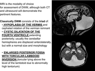 Torcular Inversion Posterior fossa malformations | PPTX