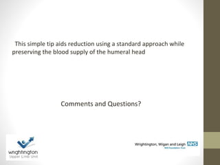 This simple tip aids reduction using a standard approach while
preserving the blood supply of the humeral head
Comments and Questions?
 