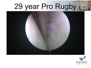 29 year Pro Rugby
 