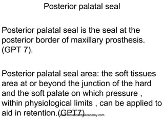 Posterior palatal seal
Posterior palatal seal is the seal at the
posterior border of maxillary prosthesis.
(GPT 7).
Poster...