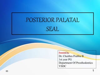 POSTERIOR PALATAL
SEAL
Dr. Chaithra Prabhu B
1st year PG
Department Of Prosthodontics
VSDC
165
 