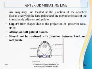 ANTERIOR VIBRATING LINE
• An imaginary line located at the junction of the attached
tissues overlying the hard palate and the movable tissues of the
immediately adjacent soft palate.
• Cupid's bow shaped due to the projection of posterior nasal
spine.
• Always on soft palatal tissues.
• Should not be confused with junction between hard and
soft palate.
Essentials of Complete Denture
Prosthodontics Winkler 2nd Ed
1765
 