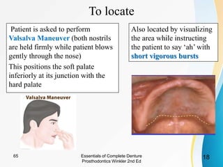 To locate
Patient is asked to perform
Valsalva Maneuver (both nostrils
are held firmly while patient blows
gently through the nose)
This positions the soft palate
inferiorly at its junction with the
hard palate
Also located by visualizing
the area while instructing
the patient to say ‘ah’ with
short vigorous bursts
Essentials of Complete Denture
Prosthodontics Winkler 2nd Ed
1865
 