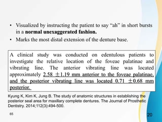 • Visualized by instructing the patient to say “ah” in short bursts
in a normal unexaggerated fashion.
• Marks the most distal extension of the denture base.
A clinical study was conducted on edentulous patients to
investigate the relative location of the foveae palatinae and
vibrating line. The anterior vibrating line was located
approximately 2.58 ±1.19 mm anterior to the foveae palatinae,
and the posterior vibrating line was located 0.71 ±0.68 mm
posterior.
Kyung K, Kim K, Jung B. The study of anatomic structures in establishing the
posterior seal area for maxillary complete dentures. The Journal of Prosthetic
Dentistry. 2014;112(3):494-500.
2065
 