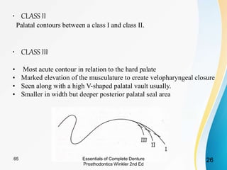 • CLASS II
Palatal contours between a class I and class II.
• CLASS III
• Most acute contour in relation to the hard palate
• Marked elevation of the musculature to create velopharyngeal closure
• Seen along with a high V-shaped palatal vault usually.
• Smaller in width but deeper posterior palatal seal area
Essentials of Complete Denture
Prosthodontics Winkler 2nd Ed
2665
 