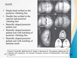 SHAPE
• Single bead scribed on the
posterior vibrating line
• Double line scribed in the
anterior and posterior
vibrating line
• Butterfly shaped posterior
palatal seal
• Butterfly shaped posterior
palatal seal with notching of
posterior vibrating line
• Butterfly shaped posterior
palatal seal with notching of
hamular notch
Goyal S, Goyal MK, Balkrishanan D, Hegde V, Narayana AI. The posterior palatal seal: Its
rationale and importance: An overview. European Journal of Prosthodontics. 2014 May
1;2(2):41-7. 3065
 