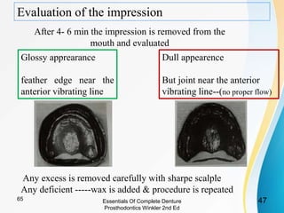 Evaluation of the impression
After 4- 6 min the impression is removed from the
mouth and evaluated
Glossy apprearance
feather edge near the
anterior vibrating line
Dull appearence
But joint near the anterior
vibrating line--(no proper flow)
Any excess is removed carefully with sharpe scalple
Any deficient -----wax is added & procedure is repeated
Essentials Of Complete Denture
Prosthodontics Winkler 2nd Ed
4765
 
