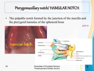 Pterygomaxillary notch/ HAMULARNOTCH
• The palpable notch formed by the junction of the maxilla and
the pterygoid hamulus of the sphenoid bone
Essentials of Complete Denture
Prosthodontics Winkler 2nd Ed
865
 