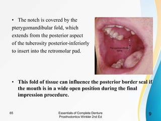 • The notch is covered by the
pterygomandibular fold, which
extends from the posterior aspect
of the tuberosity posterior-inferiorly
to insert into the retromolar pad.
• This fold of tissue can influence the posterior border seal if
the mouth is in a wide open position during the final
impression procedure.
Essentials of Complete Denture
Prosthodontics Winkler 2nd Ed
965
 