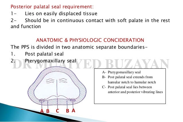 posterior palatal seal