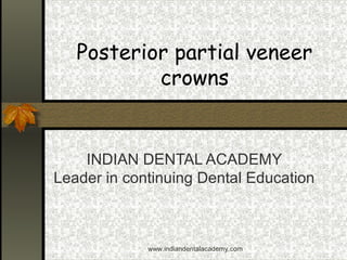 Posterior partial veneer
crowns
INDIAN DENTAL ACADEMY
Leader in continuing Dental Education
www.indiandentalacademy.com
 