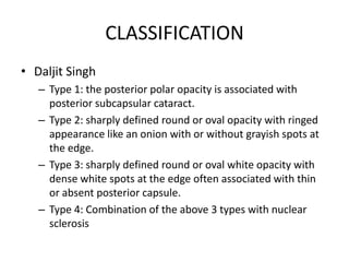 Posterior polar cataract | PPTX