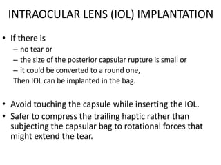 Posterior polar cataract | PPTX