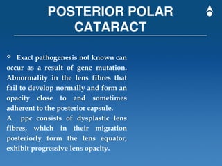 Posterior Polar Cataract PPC in the posterior cortex | PPT