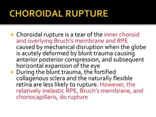 Posterior segment manifestations of blunt trauma | PPTX