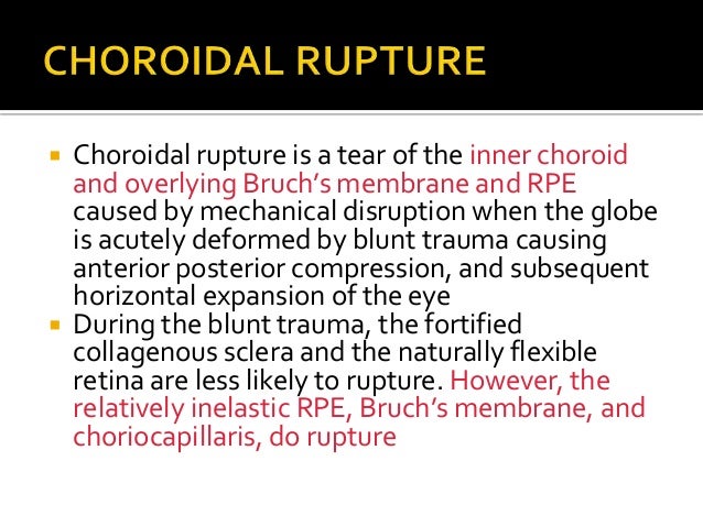 Posterior Segment Manifestations Of Blunt Trauma Posterior Segment Manifestations Of Blunt Trauma