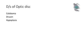 D/s of Optic disc
Coloboma
Drusen
Hypoplasia
 