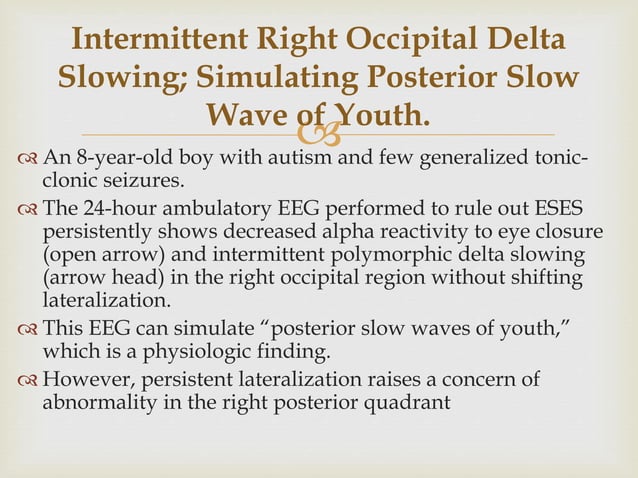 Posterior slow waves of youth | PPTX