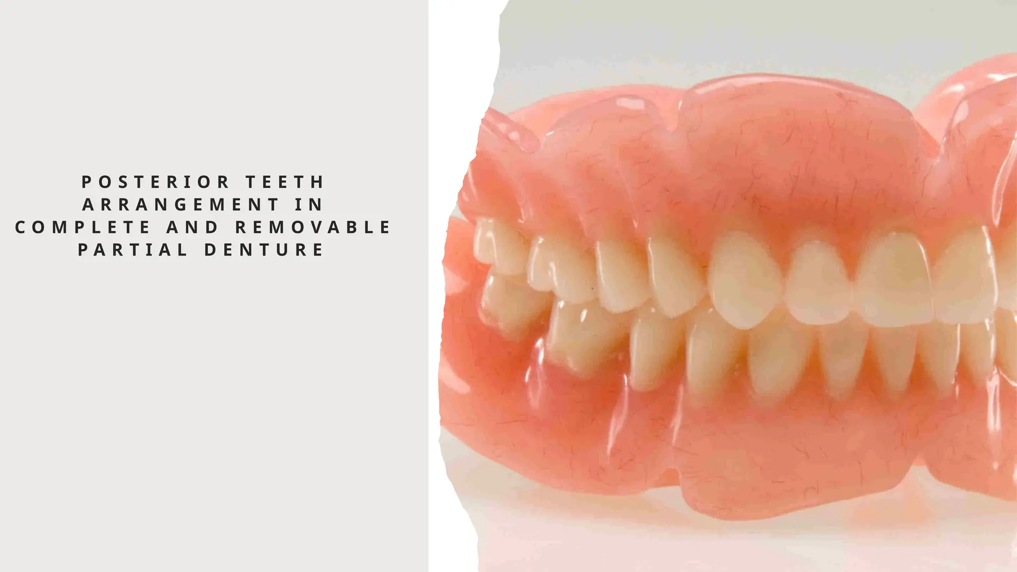 Teeth Setting complete dentures posterior teeth arrangement.pptx