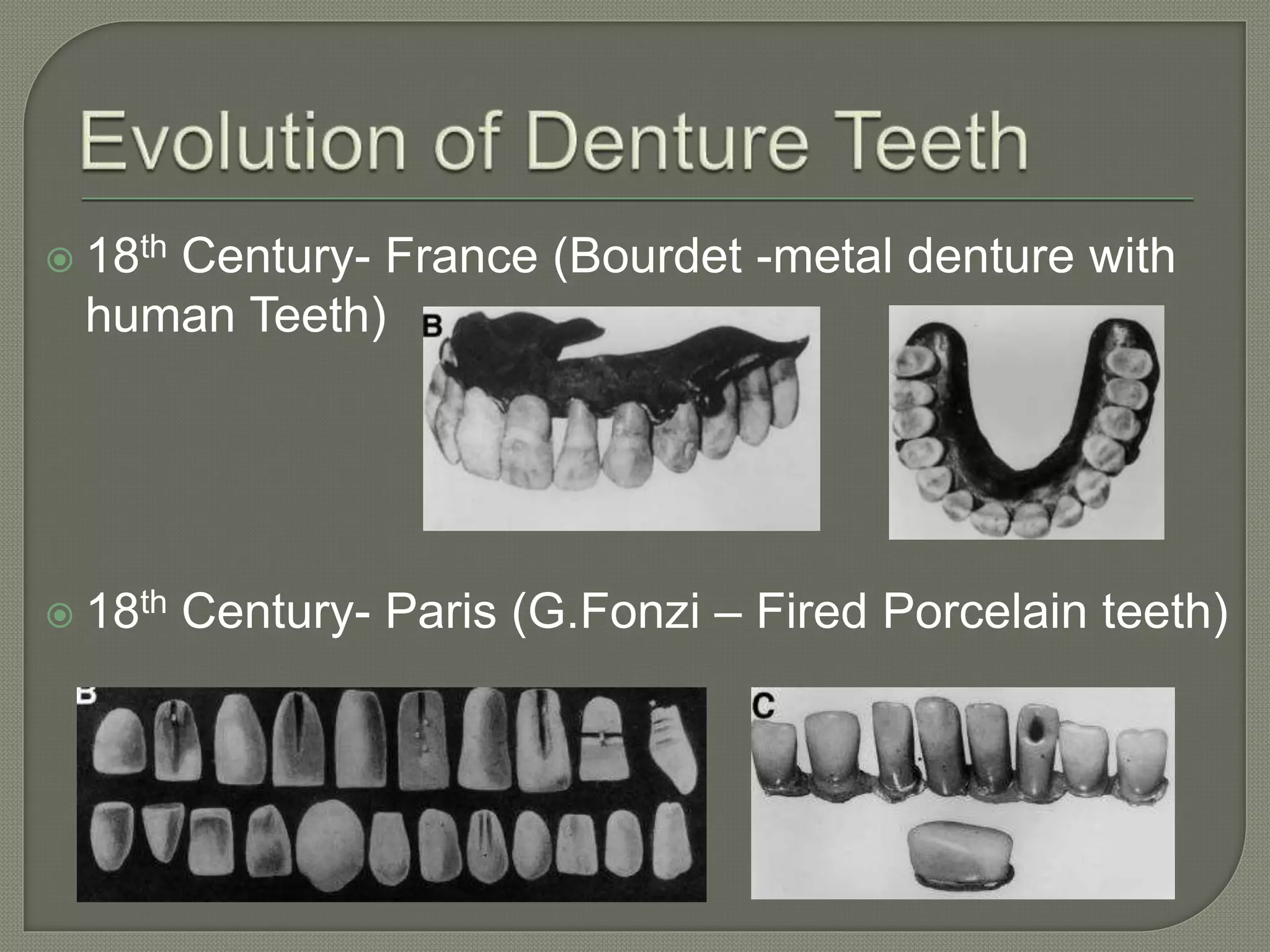 Posterior Teeth Selection in Complete Denture | PPT