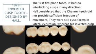 Tooth Being Inverted POSTERIOR TOOTH FORM in Complete dentures.pptx
