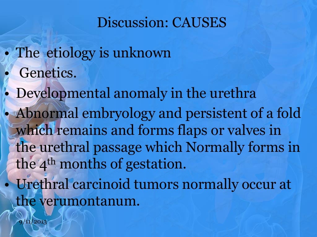 Posterior urethral valve
