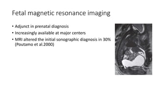 Fetal magnetic resonance imaging
• Adjunct in prenatal diagnosis
• Increasingly available at major centers
• MRI altered the initial sonographic diagnosis in 30%
(Poutamo et al.2000)
 