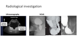 Radiological investigation
Ultrasonography VCUG
 