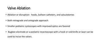 Valve Ablation
• Ablation or disruption- hooks, balloon catheters, and valvulotomes
• Both retrograde and antegrade approach
• Smaller pediatric cystoscopes with improved optics are favored
• Bugbee electrode or a pediatric resectoscope with a hook or cold knife or laser can be
used to incise the valves.
 