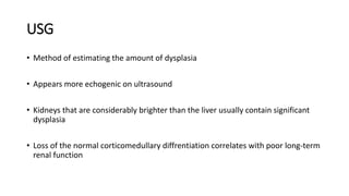 USG
• Method of estimating the amount of dysplasia
• Appears more echogenic on ultrasound
• Kidneys that are considerably brighter than the liver usually contain significant
dysplasia
• Loss of the normal corticomedullary diffrentiation correlates with poor long-term
renal function
 