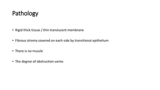Pathology
• Rigid thick tissue / thin translucent membrane
• Fibrous stroma covered on each side by transitional epithelium
• There is no muscle
• The degree of obstruction varies
 