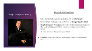 Hugh Hampton Young
Historical Overview
 Valve-like leaflets was recognized in1769 by Morgagni
 Post-mortem findings were confirmed by Langenbeck in 1802.
 Hugh Hampton Young described the first endoscopic diagnosis
of a urethral obstruction that was termed posterior urethral
valves.
 Also described the various types of PUV
 Randall carried out the first endoscopic resection of valves in
1920
 